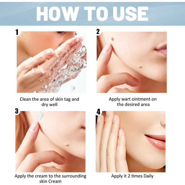Skin Clean Smooth Wart Nevi Facial Care Cream